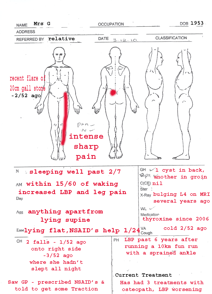 positive babinski sign causes